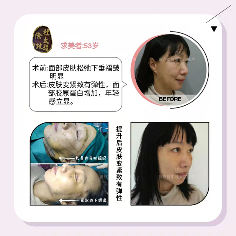 谁不想拥有青春容颜呢？