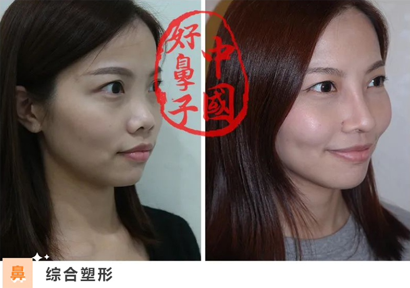 什么是好看的鼻型必备要素？