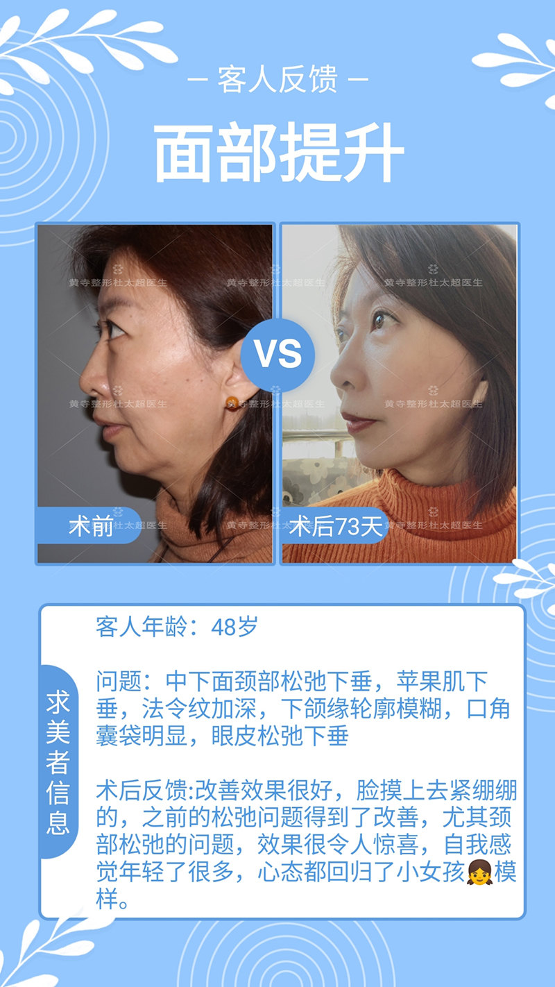 清晰的下颌缘如何打造？