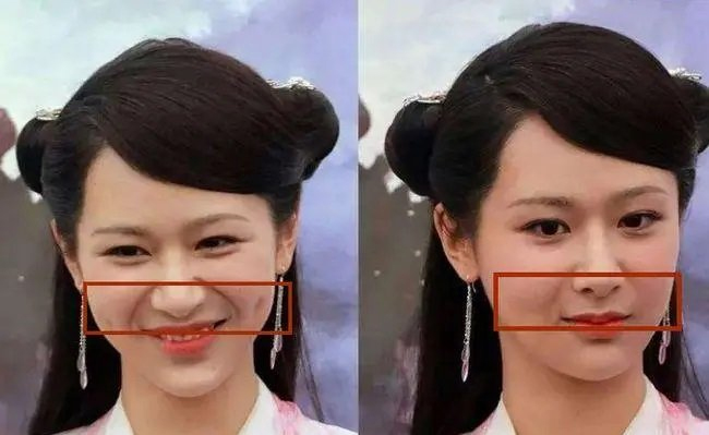 解决法令纹还得靠它 解决法令纹还得靠它