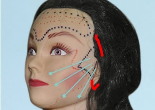 解决法令纹还得靠它 解决法令纹还得靠它