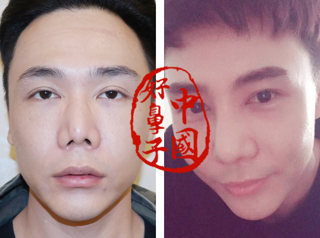 鼻修复者都面临了哪些困难？