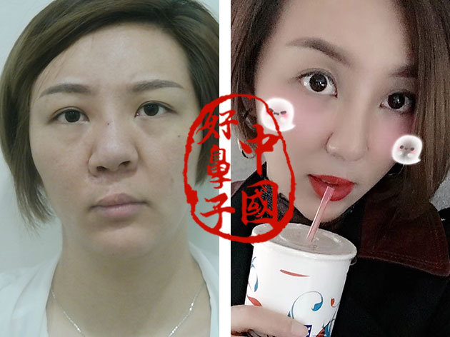 鼻修复者都面临了哪些困难？