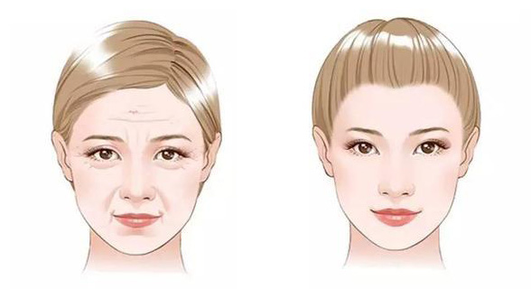 抗衰项目琳琅满目,到底谁才是心头好? 抗衰项目琳琅满目,到底谁才是心头好?