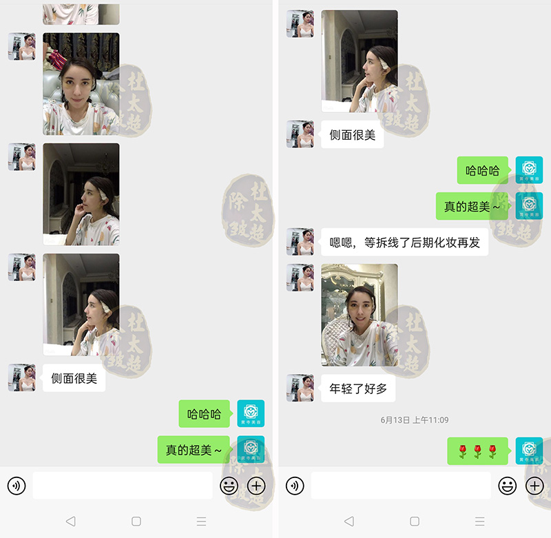 抗衰项目琳琅满目,到底谁才是心头好? 抗衰项目琳琅满目,到底谁才是心头好?