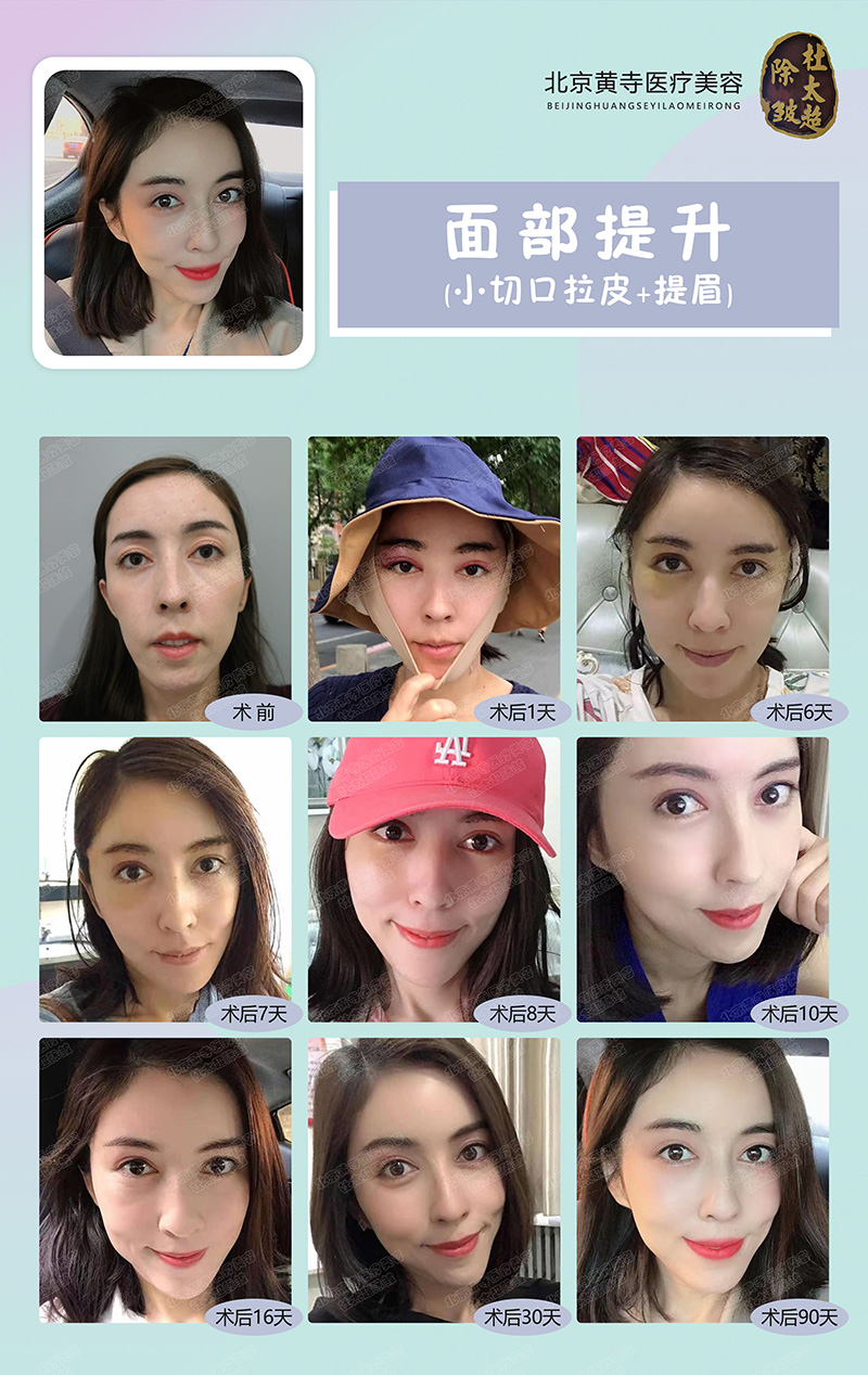 抗衰项目琳琅满目,到底谁才是心头好? 抗衰项目琳琅满目,到底谁才是心头好?