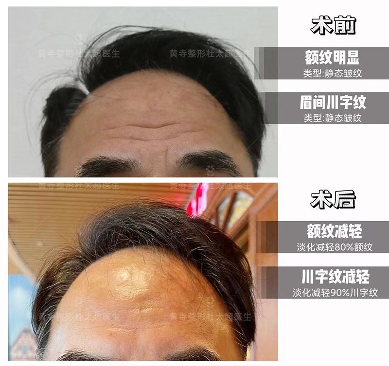 抗衰要趁早 抗衰要趁早