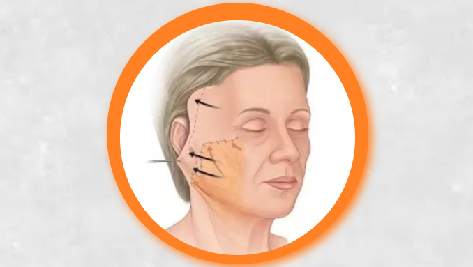 「小切口 」到底有效果吗? 「小切口 」到底有效果吗?