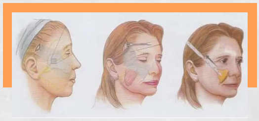 「小切口 」到底有效果吗? 「小切口 」到底有效果吗?