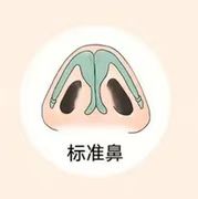 大鼻头缩小如何做? 大鼻头缩小如何做?