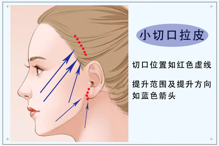 小切口的这类问题您还在关注吗？