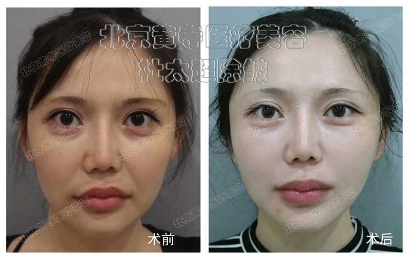 小切口的这类问题您还在关注吗？