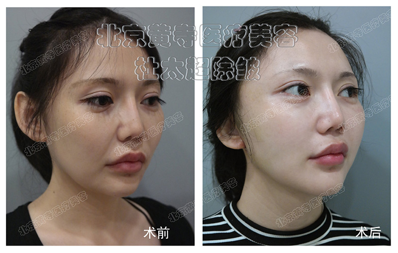 小切口的这类问题您还在关注吗？