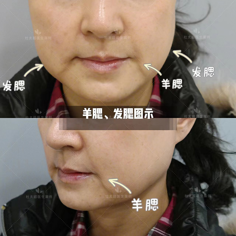 容易混淆的“羊腮”和“发腮”，你能清楚分辨吗？