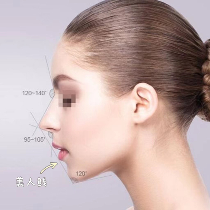 哪些是不符合鼻部美学标准的