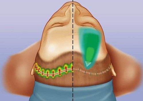 三分钟概览小切口拉皮！