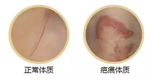 这类人群不适合做鼻子！