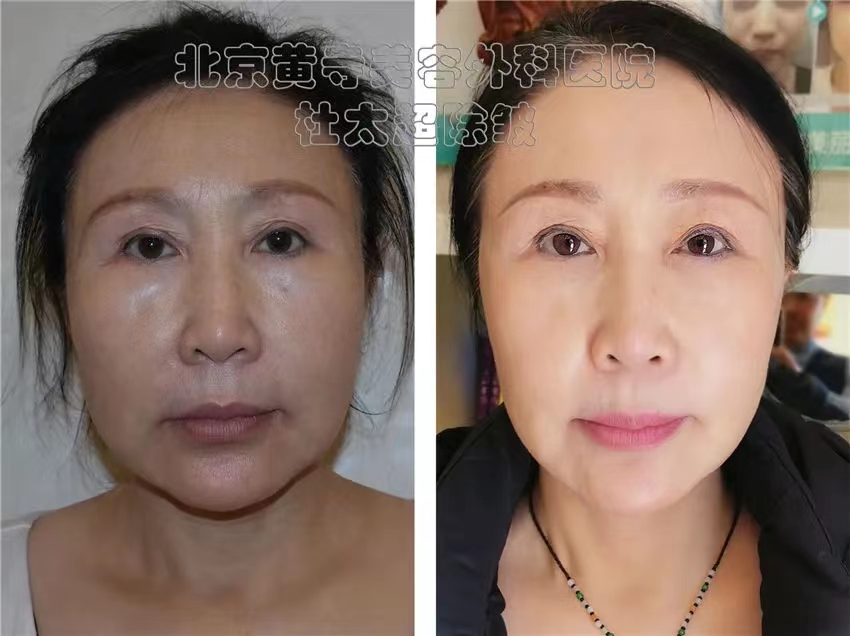 为什么无论做多少次都没有提升效果？