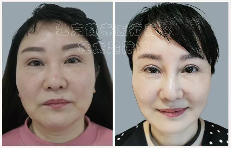 为什么到一定年纪脸就变大呢？