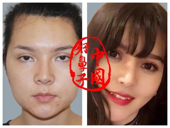 塑型怎样的鼻尖才好看? 塑型怎样的鼻尖才好看?