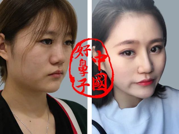 自然好看、能摸能动不惧揉捏的“中国好鼻子”! 自然好看、能摸能动不惧揉捏的“中国好鼻子”!