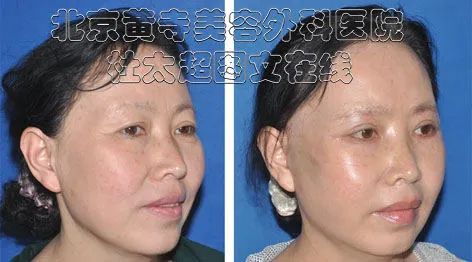 避开“抗衰”这些坑... 避开“抗衰”这些坑...