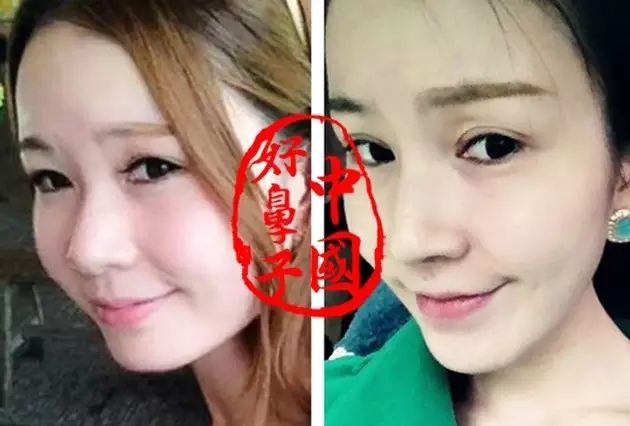 宽鼻如何“修饰”才能更加有型？