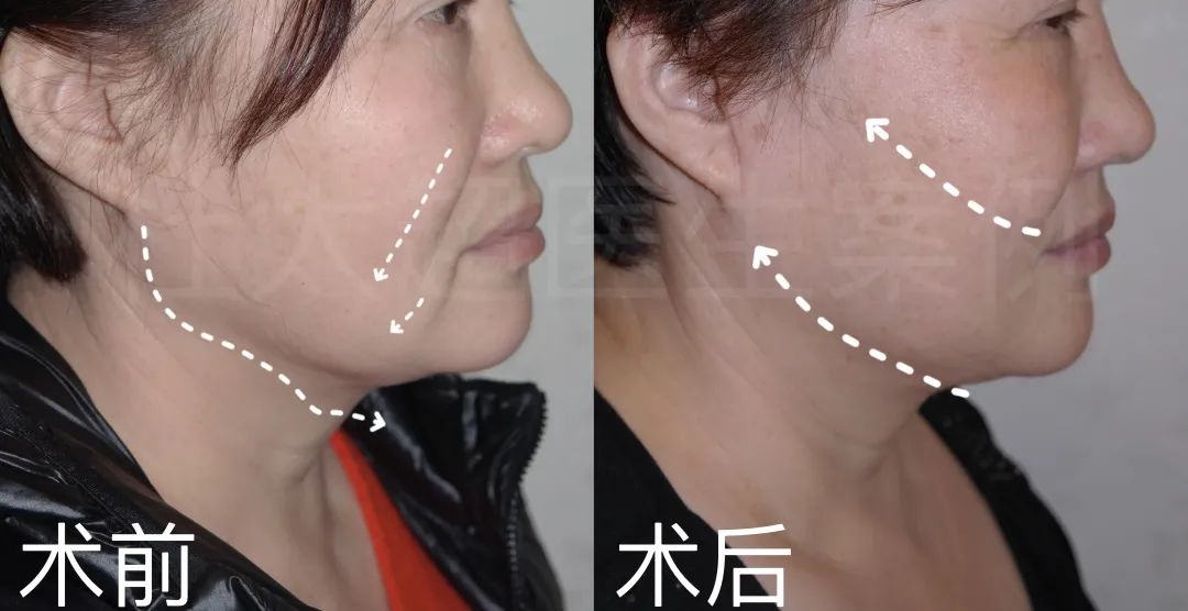 面部年轻化从这里开始了解... 面部年轻化从这里开始了解...