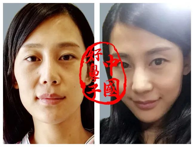 从「短鼻」开始了解...