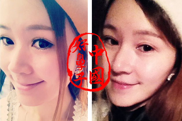 鼻头肥大该如何改善…