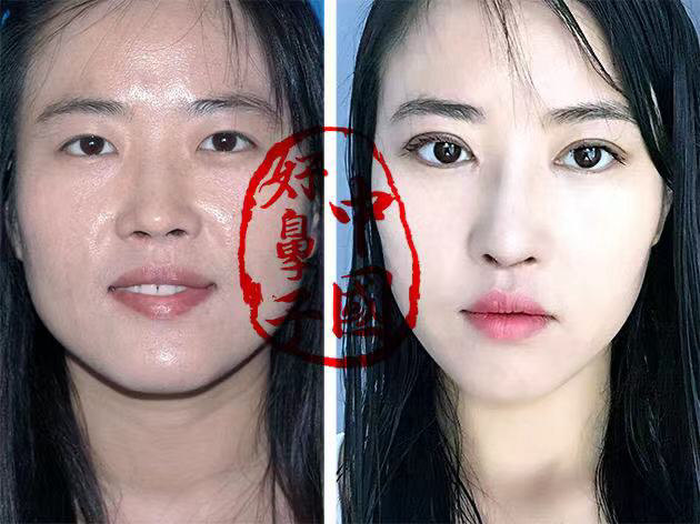 你渴望拥有秀气的鼻子吗? 你渴望拥有秀气的鼻子吗?