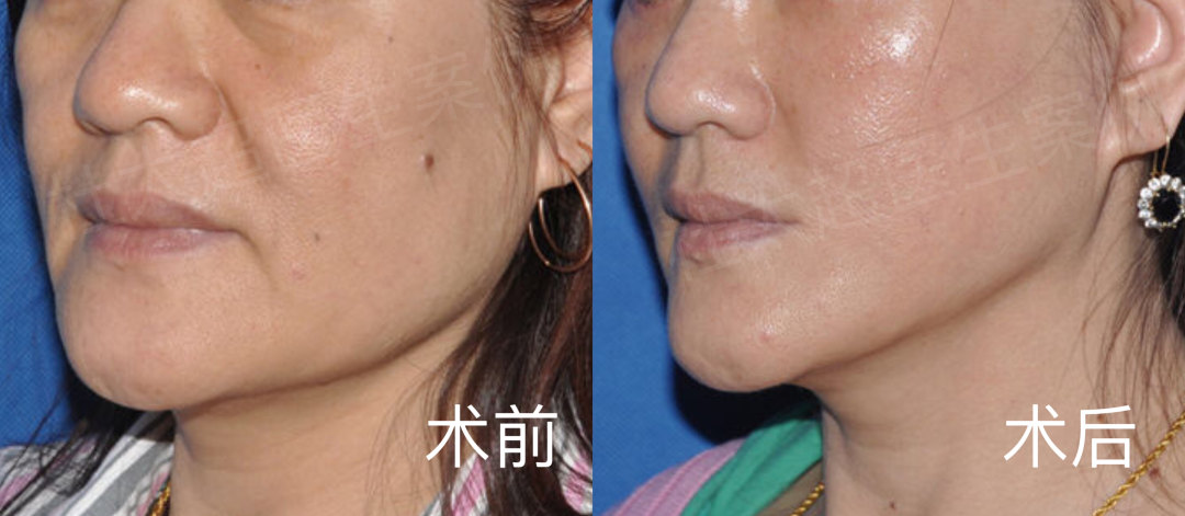 看脸的时代，你的脸经得起考验吗？