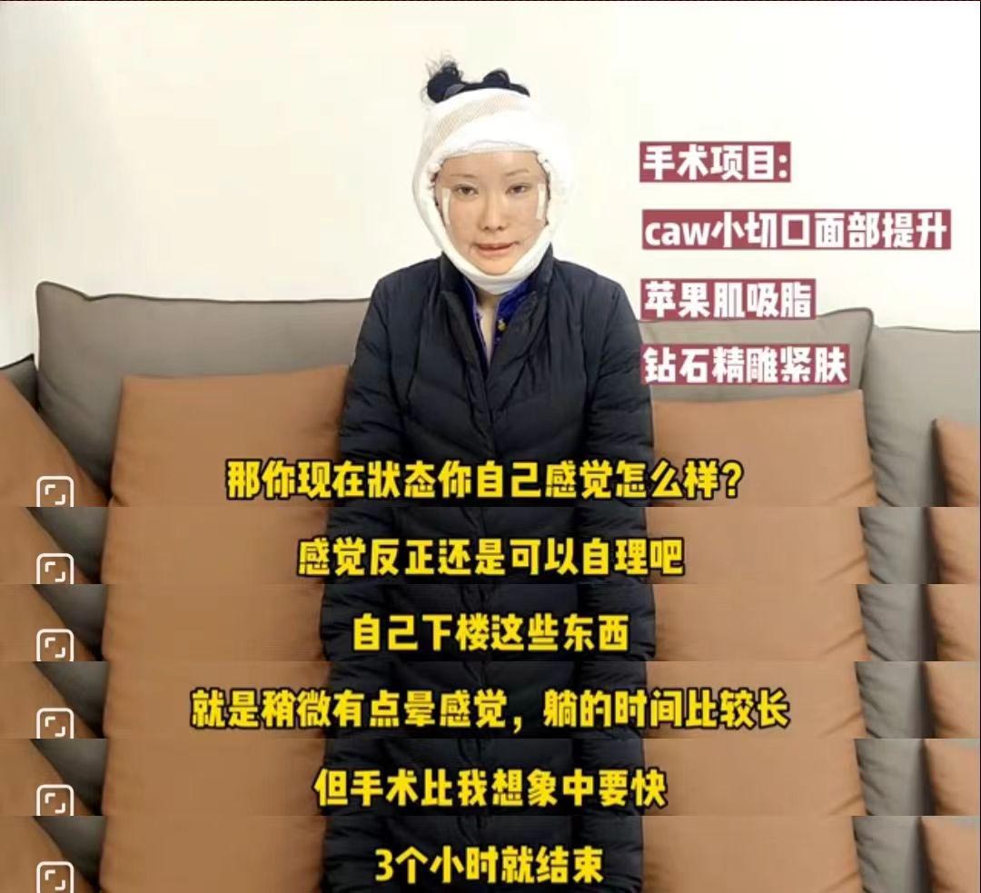 39岁求美者追求面部年轻感，公开术后效果