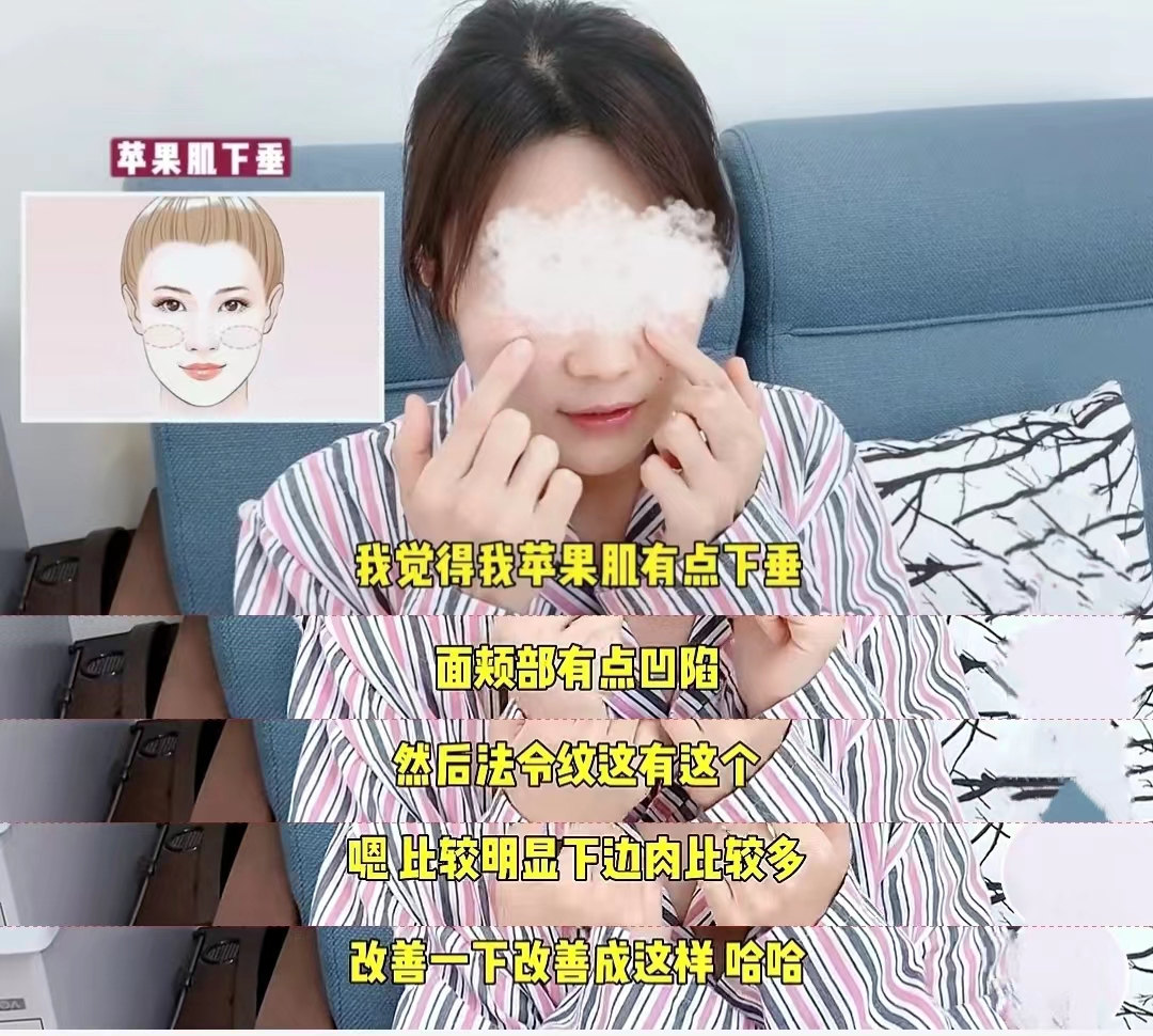 苹果肌下垂、面颊凹陷、法令纹，分享拉皮手术过程及感受