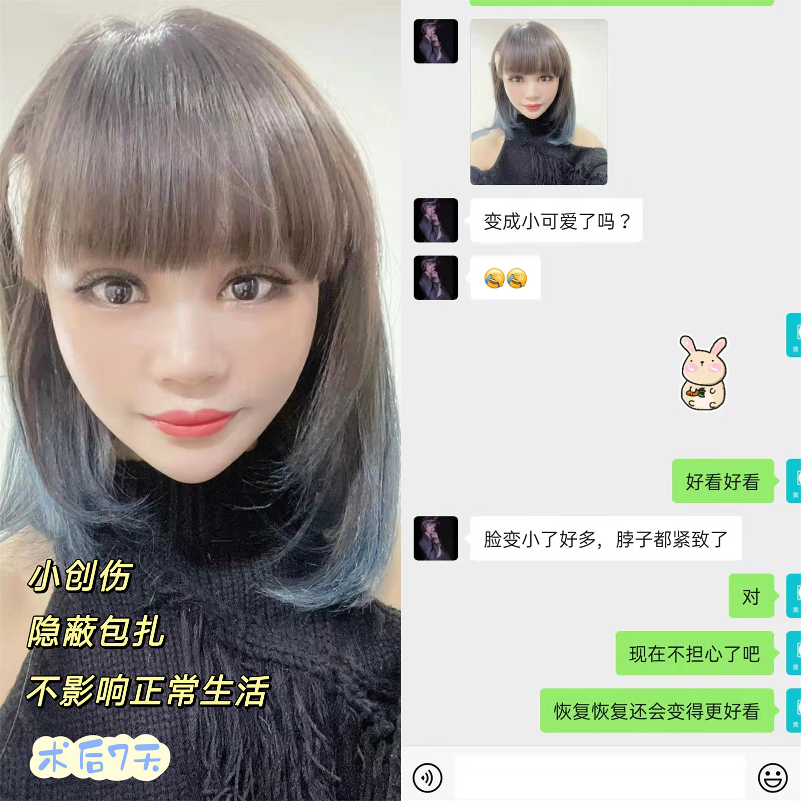 做拉皮手术需要住院吗？