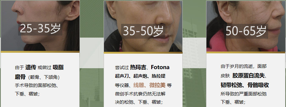 解决面部松弛、脂肪堆积、发腮问题！线雕拉皮怎么选？