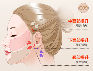 医美小白想做拉皮手术，必须知道这6件事！