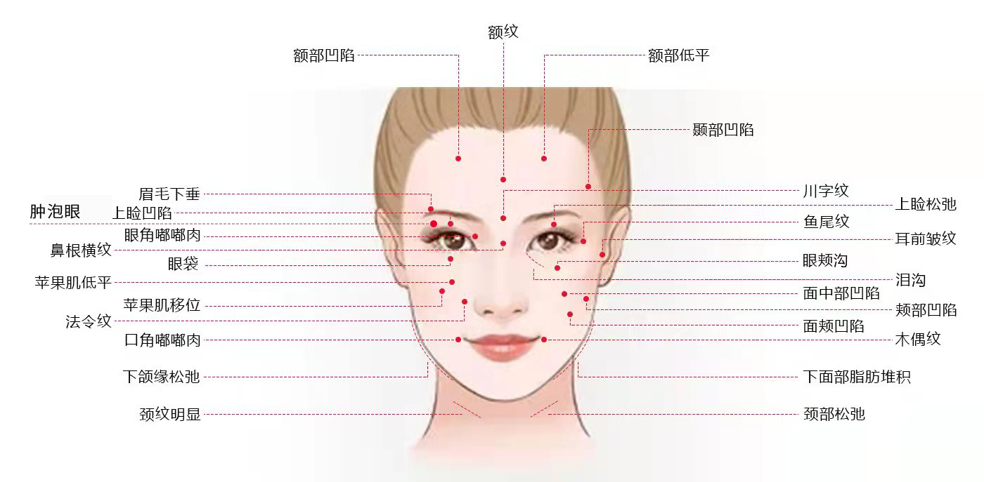 医美小白想做拉皮手术，必须知道这6件事！