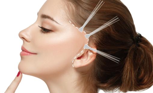 医美小白做拉皮手术前,应如何正确避坑? 医美小白做拉皮手术前,应如何正确避坑?