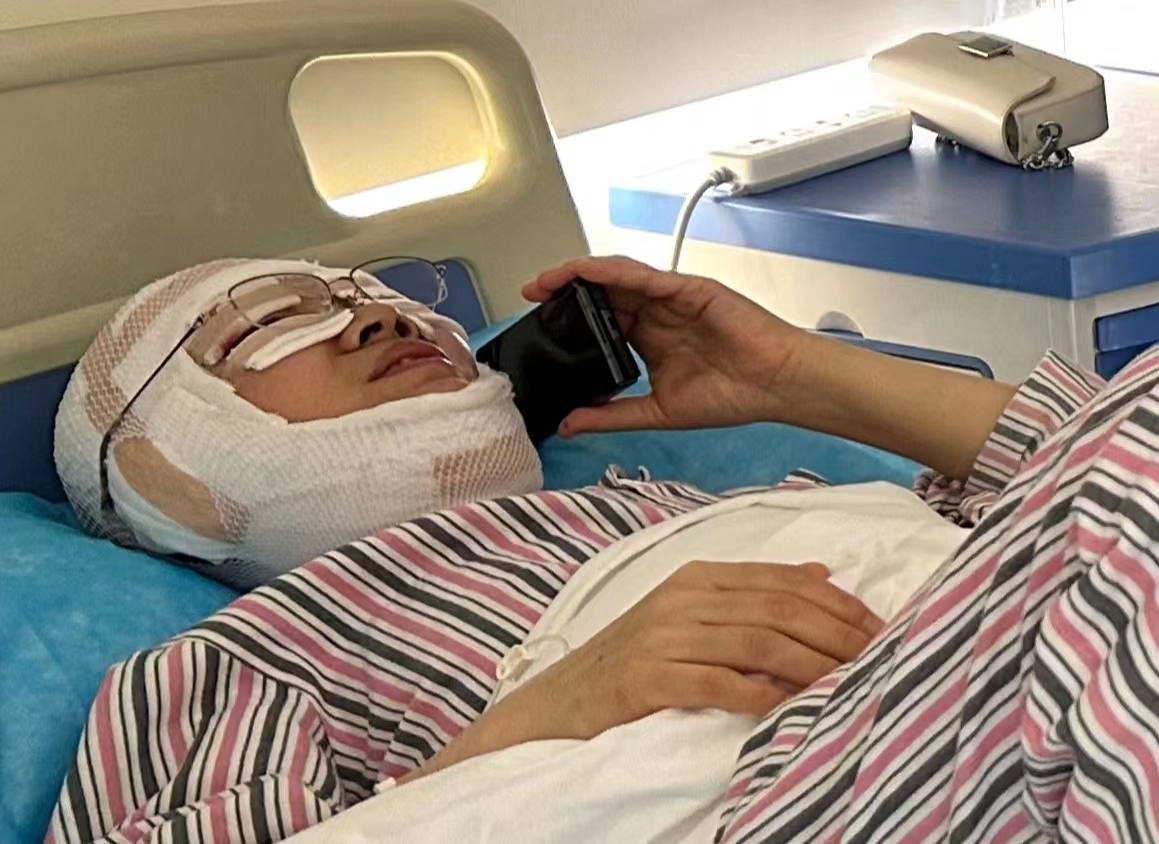 关于拉皮手术,你最关心的三件事,答案全在这里! 关于拉皮手术,你最关心的三件事,答案全在这里!