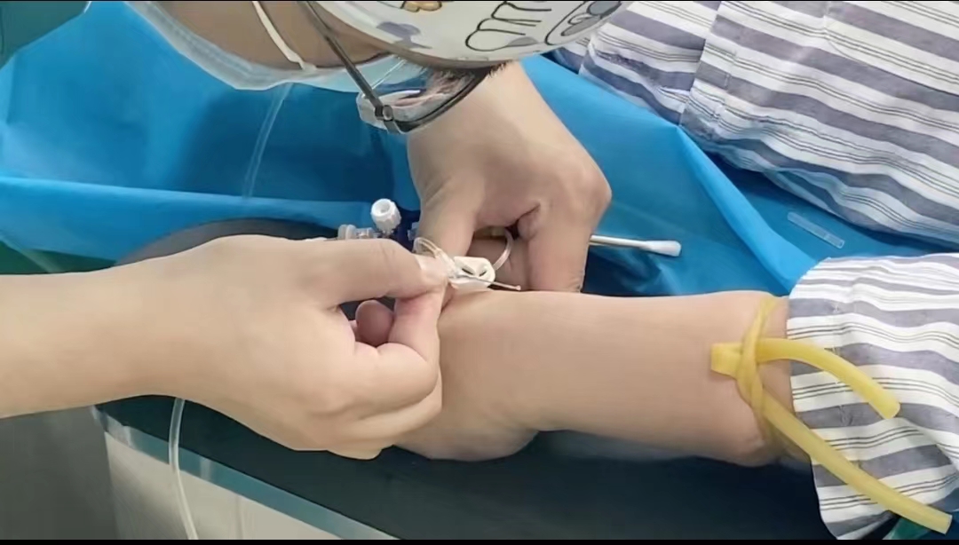 拉皮手术成功后的第7天，赢麻了！