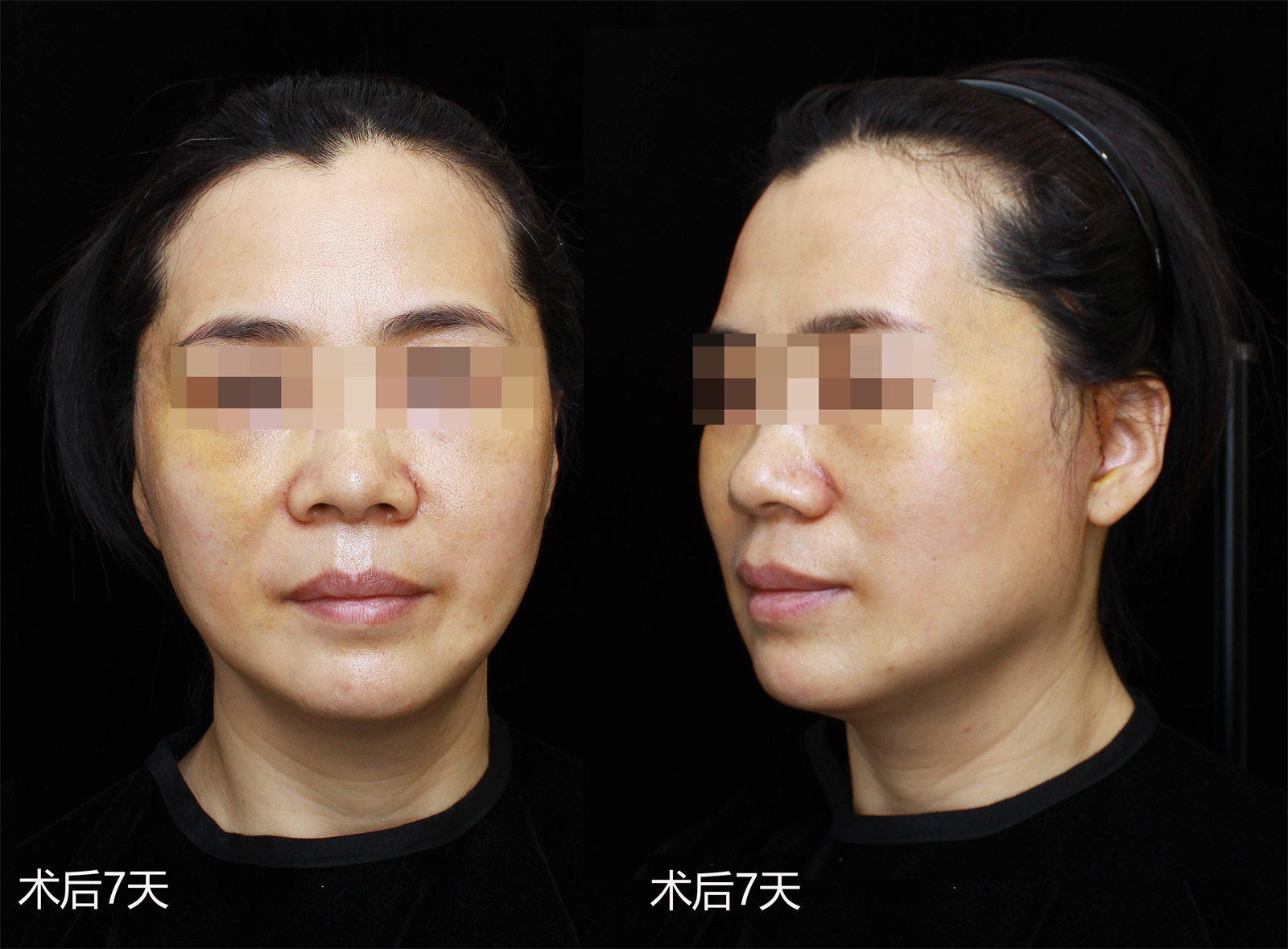 49岁还不如52岁的闺蜜年轻，只因她做了……