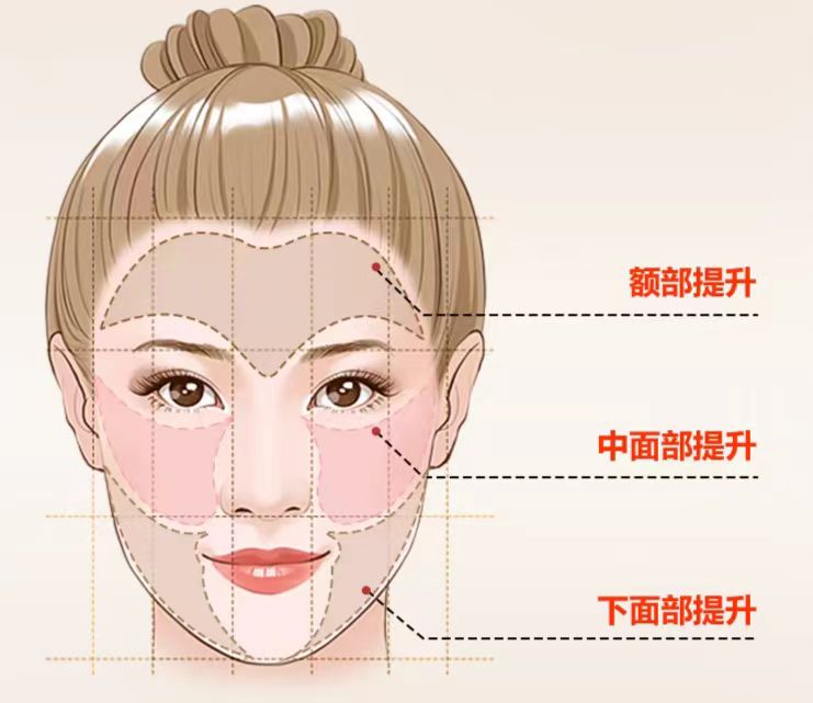 回答你最关心的“拉皮手术”的5大问题，包括价格！