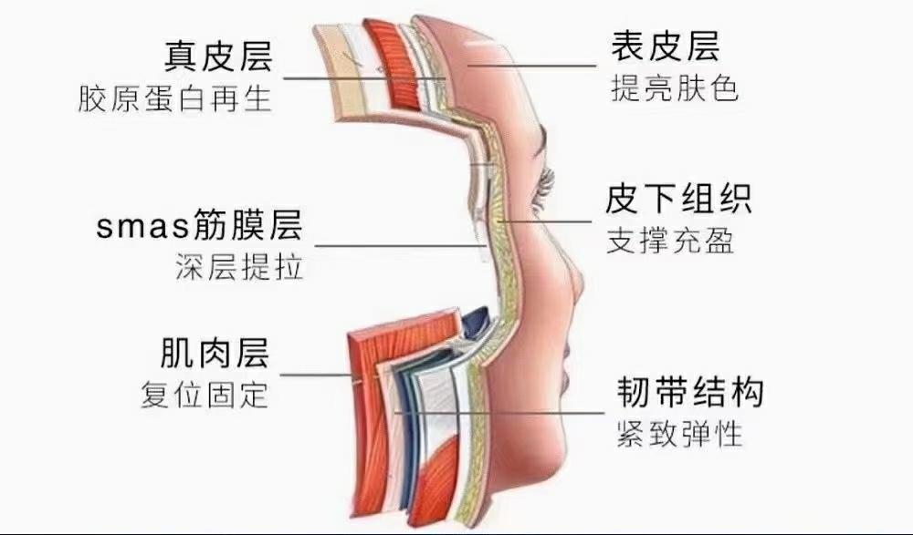 回答你最关心的“拉皮手术”的5大问题，包括价格！
