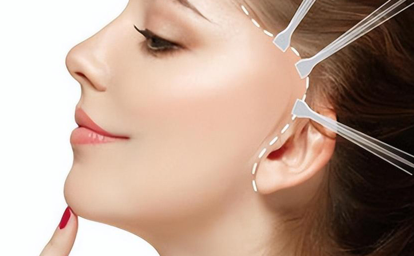 法令纹深，填充和拉皮手术哪个更有效？
