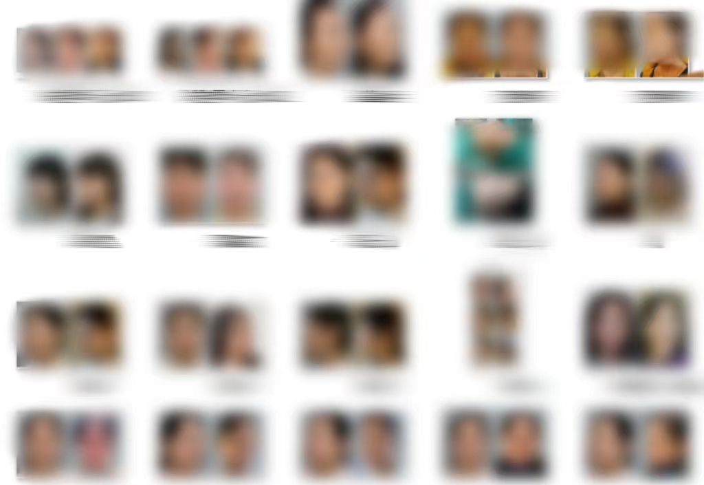 总被问有没有60岁！不甘心做了拉皮手术，第7天拍照，很惊喜