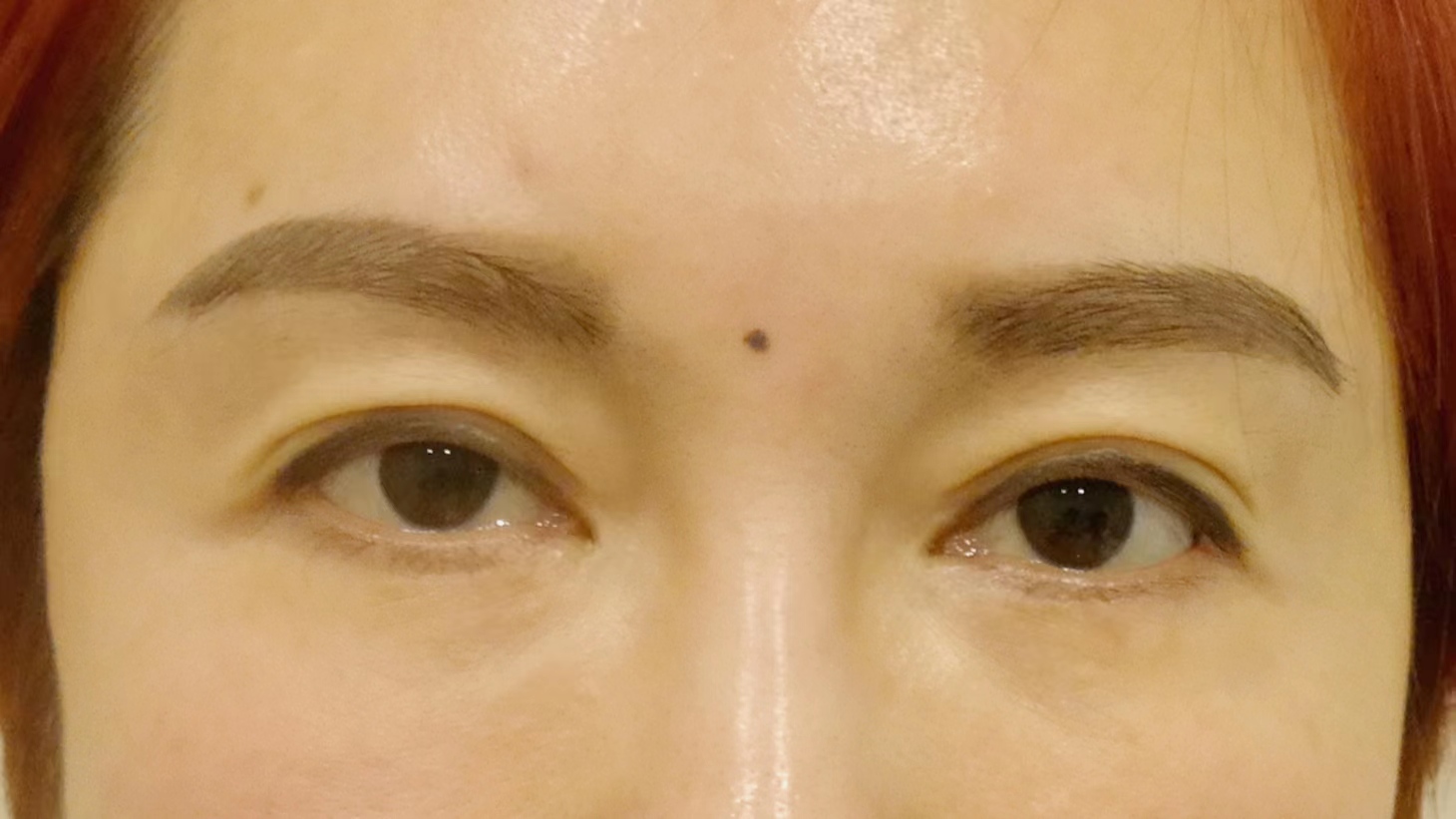 眼睛无神显老,一招改善眼皮松弛衰老问题! 眼睛无神显老,一招改善眼皮松弛衰老问题!