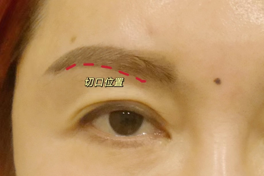 眼睛无神显老,一招改善眼皮松弛衰老问题! 眼睛无神显老,一招改善眼皮松弛衰老问题!