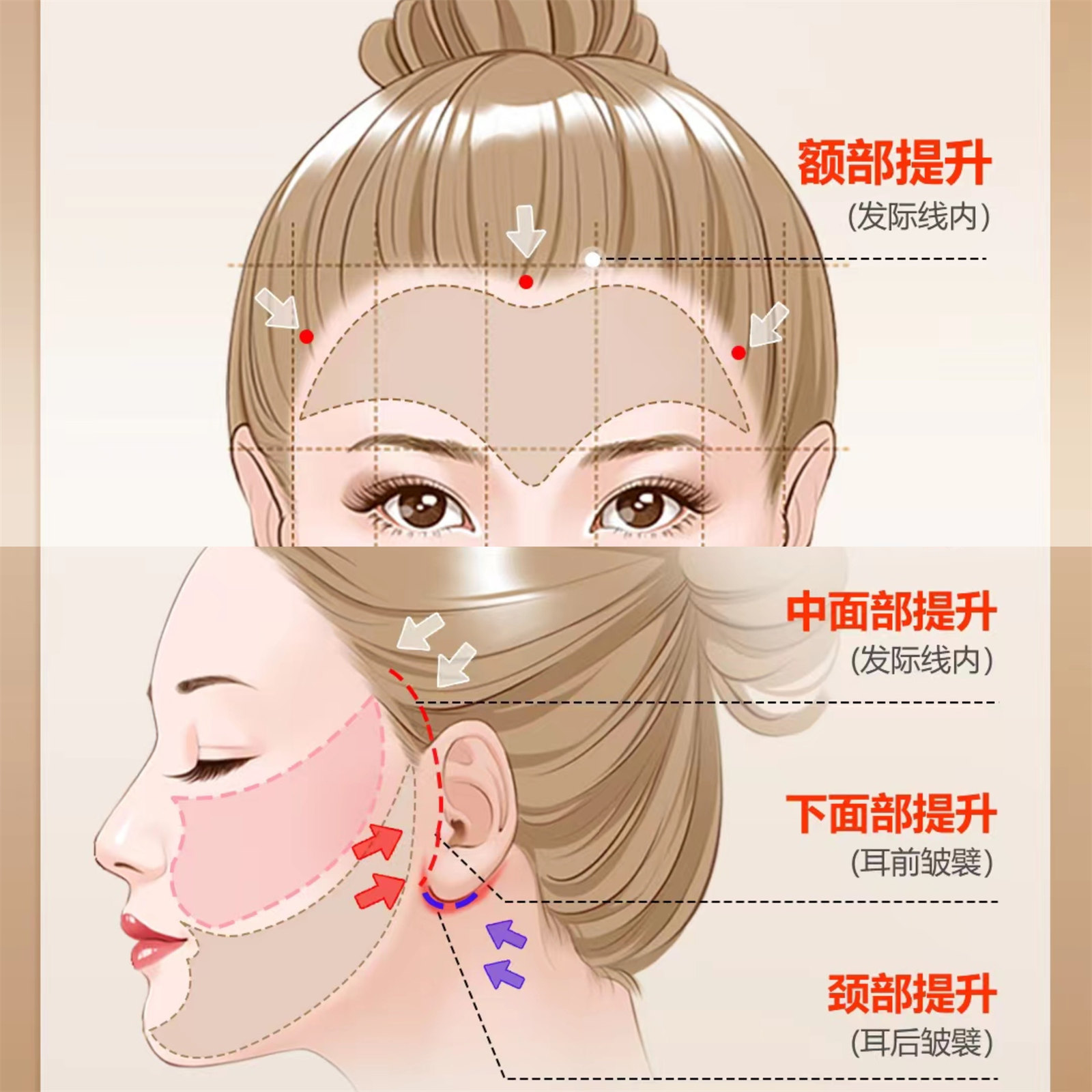 关于拉皮手术提升/除皱,来自求美者的提问与医生回复 关于拉皮手术提升/除皱,来自求美者的提问与医生回复