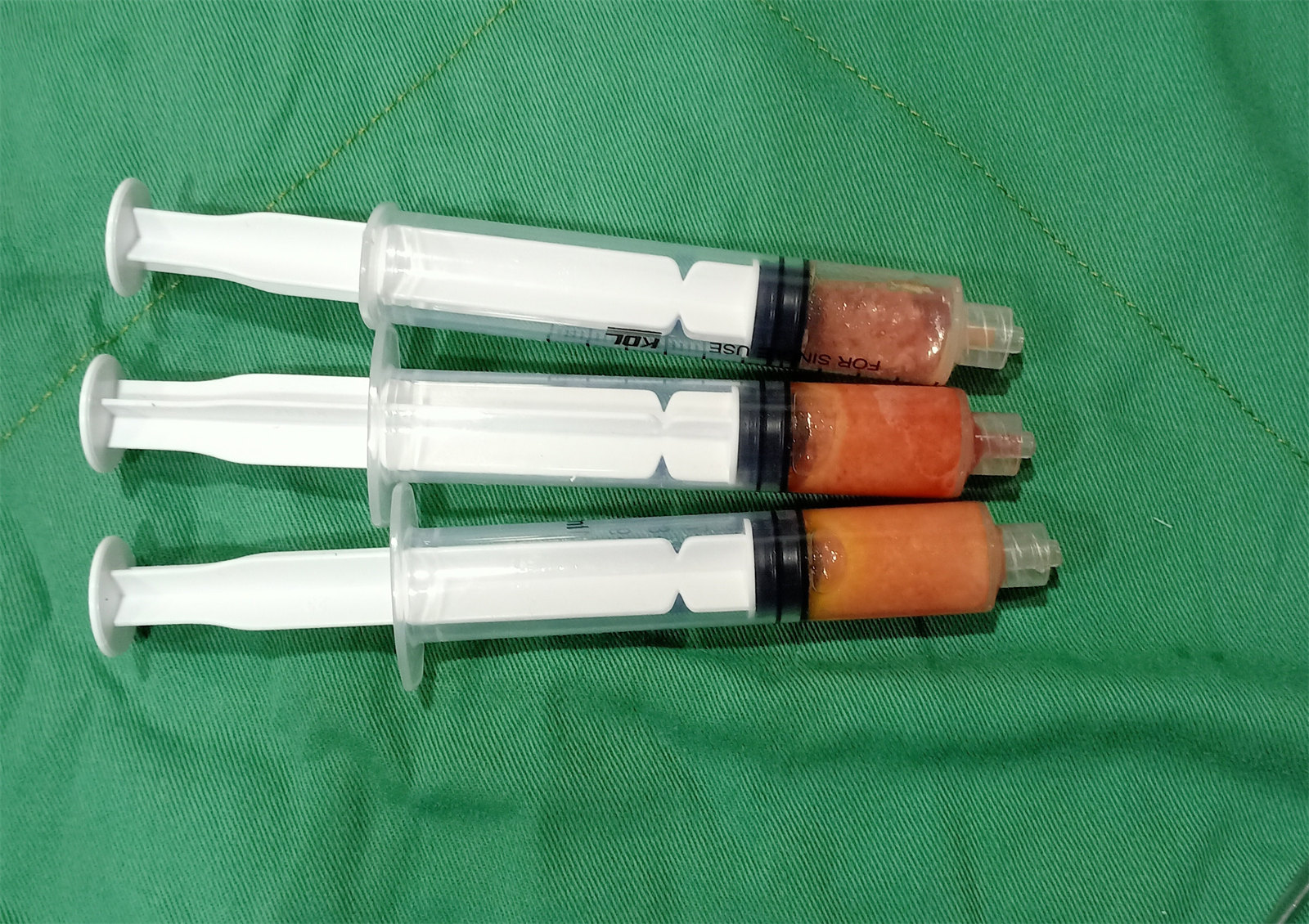 36岁做了拉皮手术,结合亲身感受,回复大家的3个问题 36岁做了拉皮手术,结合亲身感受,回复大家的3个问题